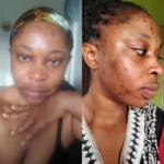 neutriherbs-5-step-acne-routine-for-clear-skin-customer-review_1000x